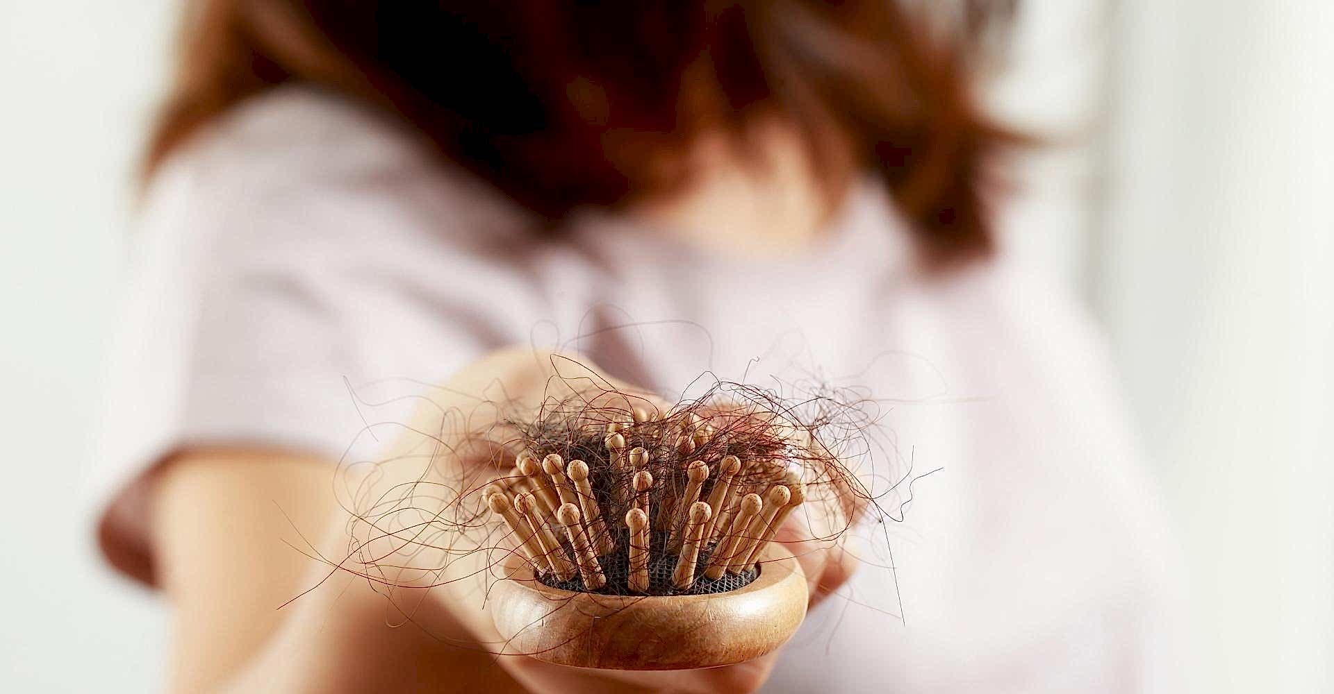 Saç Dökülmesi Nedenleri Nelerdir?